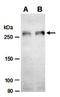 RB Binding Protein 6, Ubiquitin Ligase antibody, orb66762, Biorbyt, Western Blot image 