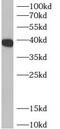 ADP-Ribosylhydrolase Like 2 antibody, FNab00544, FineTest, Western Blot image 