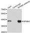 NFKB Inhibitor Alpha antibody, LS-C746963, Lifespan Biosciences, Immunoprecipitation image 