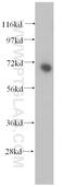 Methyltransferase Like 3 antibody, 15073-1-AP, Proteintech Group, Western Blot image 