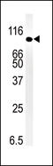 SMAD Specific E3 Ubiquitin Protein Ligase 1 antibody, MBS9202627, MyBioSource, Western Blot image 