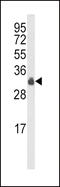 MYD88 Innate Immune Signal Transduction Adaptor antibody, MBS9209108, MyBioSource, Western Blot image 