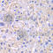 Enoyl-CoA Hydratase And 3-Hydroxyacyl CoA Dehydrogenase antibody, A5717, ABclonal Technology, Immunohistochemistry paraffin image 