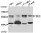 Tubulin Folding Cofactor E antibody, STJ29589, St John