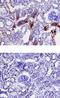 Serine Protease 3 antibody, MA5-24156, Invitrogen Antibodies, Immunohistochemistry paraffin image 
