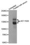 c-Kit antibody, MBS128477, MyBioSource, Western Blot image 