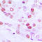 Cyclin E1 antibody, LS-C351952, Lifespan Biosciences, Immunohistochemistry frozen image 