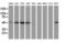 Sequestosome 1 antibody, LS-C172547, Lifespan Biosciences, Western Blot image 