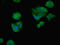 DEAD-Box Helicase 3 X-Linked antibody, CSB-PA006621LA01HU, Cusabio, Immunofluorescence image 