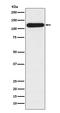 BUB1 Mitotic Checkpoint Serine/Threonine Kinase B antibody, M01564-1, Boster Biological Technology, Western Blot image 