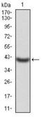 Potassium Voltage-Gated Channel Subfamily D Member 2 antibody, NBP2-52498, Novus Biologicals, Western Blot image 