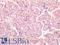 TAR DNA Binding Protein antibody, LS-B16438, Lifespan Biosciences, Immunohistochemistry paraffin image 