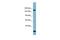 Glutamyl-Prolyl-TRNA Synthetase antibody, PA5-42817, Invitrogen Antibodies, Western Blot image 