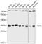 Enoyl-CoA Hydratase 1 antibody, GTX66141, GeneTex, Western Blot image 