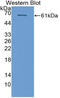 Cytochrome P450 Family 26 Subfamily B Member 1 antibody, LS-C314965, Lifespan Biosciences, Western Blot image 