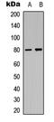 Microtubule Associated Protein Tau antibody, LS-C368451, Lifespan Biosciences, Western Blot image 