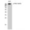 Serine/threonine-protein kinase D1 antibody, LS-C380932, Lifespan Biosciences, Western Blot image 