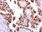 Protein Kinase, DNA-Activated, Catalytic Subunit antibody, GTX109673, GeneTex, Immunohistochemistry paraffin image 