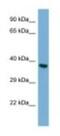 Twinfilin Actin Binding Protein 2 antibody, NBP1-98388, Novus Biologicals, Western Blot image 