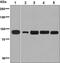 Transient Receptor Potential Cation Channel Subfamily V Member 5 antibody, ab137028, Abcam, Western Blot image 