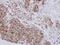 NADH:Ubiquinone Oxidoreductase Subunit B10 antibody, PA5-30100, Invitrogen Antibodies, Immunohistochemistry paraffin image 