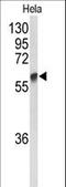 Polypeptide N-Acetylgalactosaminyltransferase 2 antibody, LS-C166354, Lifespan Biosciences, Western Blot image 