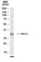 Inhibitor Of Growth Family Member 2 antibody, PA1-31556, Invitrogen Antibodies, Western Blot image 