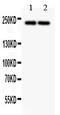 Dicer 1, Ribonuclease III antibody, LS-C357454, Lifespan Biosciences, Western Blot image 