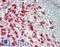 Karyopherin Subunit Alpha 2 antibody, LS-B14456, Lifespan Biosciences, Immunohistochemistry paraffin image 