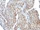 Estrogen Receptor 2 antibody, V2494IHC-7ML, NSJ Bioreagents, Immunohistochemistry paraffin image 