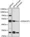 Beta-1,3-N-Acetylgalactosaminyltransferase 1 (Globoside Blood Group) antibody, A09960, Boster Biological Technology, Western Blot image 
