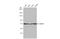 Heat Shock Protein Family A (Hsp70) Member 8 antibody, GTX134584, GeneTex, Western Blot image 