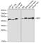 Isocitrate Dehydrogenase (NADP(+)) 1, Cytosolic antibody, GTX55670, GeneTex, Western Blot image 