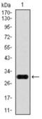 Glypican 3 antibody, abx015875, Abbexa, Western Blot image 