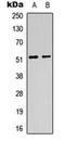 PD-L1 antibody, orb235069, Biorbyt, Western Blot image 