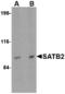 SATB Homeobox 2 antibody, A02588, Boster Biological Technology, Western Blot image 