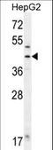 Fumarylacetoacetate Hydrolase antibody, LS-C165918, Lifespan Biosciences, Western Blot image 