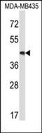 Mitochondrial Ribosomal Protein L17 antibody, orb224116, Biorbyt, Western Blot image 
