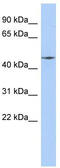 Ribosomal Modification Protein RimK Like Family Member A antibody, TA331406, Origene, Western Blot image 