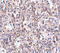 Scavenger Receptor Class B Member 1 antibody, A01093, Boster Biological Technology, Immunohistochemistry paraffin image 