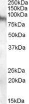 Neuroligin 3 antibody, MBS420494, MyBioSource, Western Blot image 