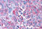 Corticotropin Releasing Hormone Receptor 1 antibody, MBS247197, MyBioSource, Immunohistochemistry frozen image 