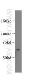 Phosphatidylinositol-4-Phosphate 5-Kinase Type 1 Alpha antibody, 15713-1-AP, Proteintech Group, Western Blot image 