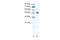 Cholinergic Receptor Nicotinic Beta 2 Subunit antibody, 31-096, ProSci, Enzyme Linked Immunosorbent Assay image 