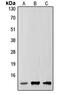 Small Ubiquitin Like Modifier 2 antibody, LS-C352868, Lifespan Biosciences, Western Blot image 