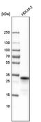 Major Histocompatibility Complex, Class II, DR Beta 5 antibody, NBP2-14093, Novus Biologicals, Western Blot image 