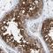 RuvB Like AAA ATPase 1 antibody, NBP1-84914, Novus Biologicals, Immunohistochemistry frozen image 