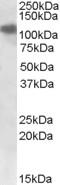 Sulfatase 1 antibody, EB09199, Everest Biotech, Western Blot image 