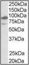 Nuclear Receptor Subfamily 1 Group H Member 2 antibody, AP22491PU-N, Origene, Western Blot image 