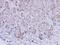 Exosome Component 10 antibody, GTX107856, GeneTex, Immunohistochemistry paraffin image 